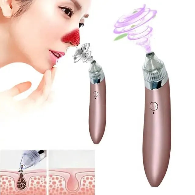 5-in-1 blackhead remover with 3 adjustable suction levels for different skin types