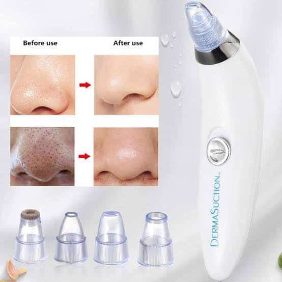 Using Ultimate Derma Suction Blackhead Remover Machine to remove blackheads and cleanse pores