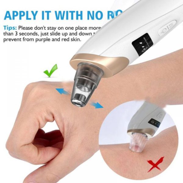 Electric Blackhead Suction Remover – Portable Pore Cleaner with LED Display & Adjustable Suction